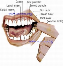 rotting molars teeth